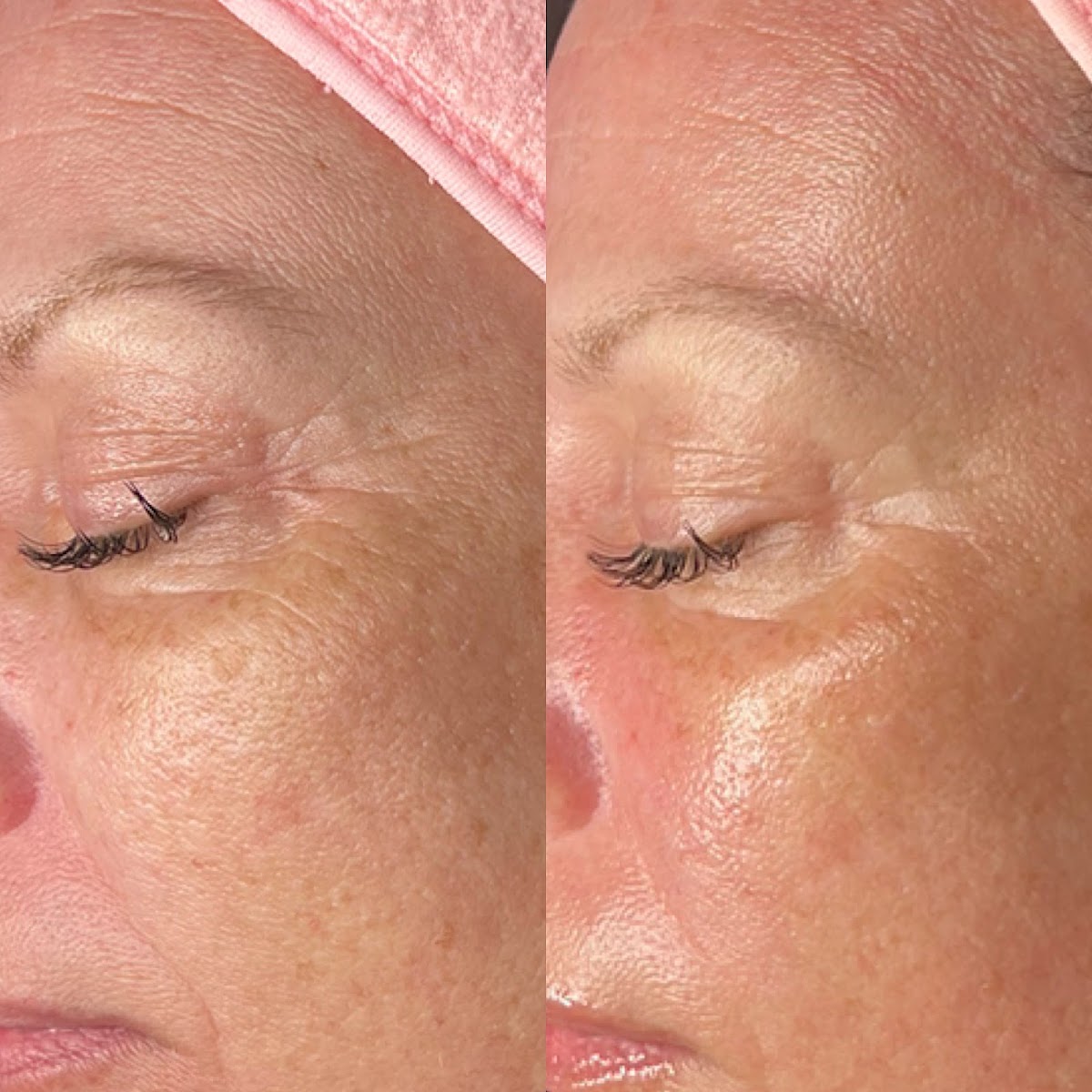 EverGlow Medi Spa photo 2